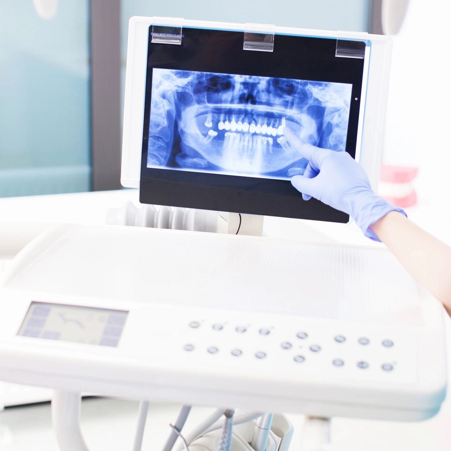 Dentist examining a dental X-ray on a computer screen.